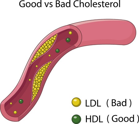Heart health and cholesterol management